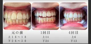 エクシアホワイト長野店所属・セルフホワイトニング エクシア長野店のその他イメージ