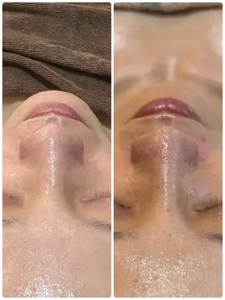 ハーブ/小顔/リンパ /大阪狭山市のエステ・リラクイメージ