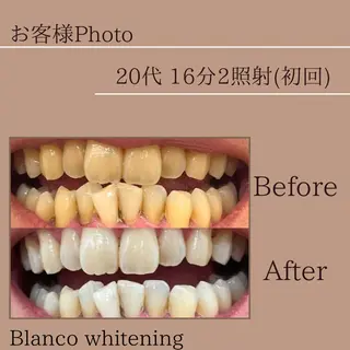 Blanco東大宮駅前店所属・blanco 東大宮駅前店のその他イメージ