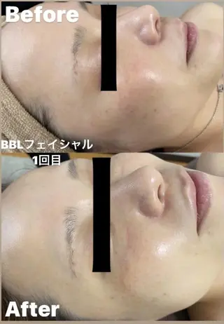 メンズ Epina 千葉店 【エピナ】のエステ・リラクイメージ