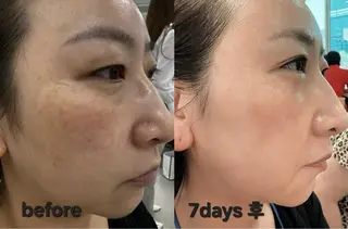 【敏感肌管理×小顔サロン】Belle orchid所属・敏感肌×小顔サロン 玲央奈のエステ・リラクイメージ