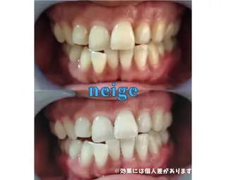 ホワイトニングサロン ネージュ(女性専用)のその他イメージ