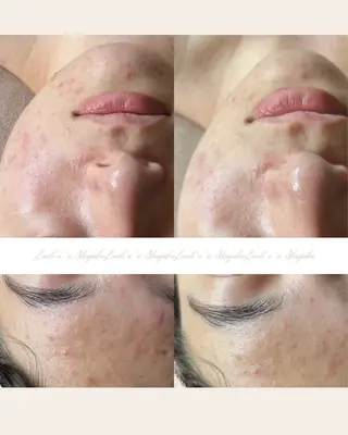 美腸サロン🌺 腸もみ/小顔/リンパのエステ・リラクイメージ