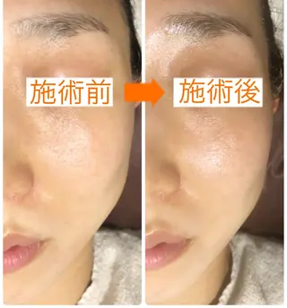 小顔・毛穴・たるみ ネイル　似内真樹のエステ・リラクイメージ