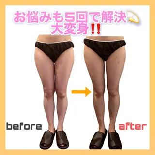 市瀬 朱里のエステ・リラクイメージ