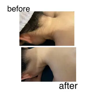 ３歳～フォト美肌脱毛 Dione湘南藤沢店のエステ・リラクイメージ