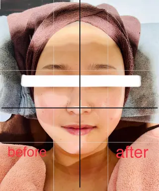 脱毛フェイシャル痩身 エリア最安👑永野舞のエステ・リラクイメージ