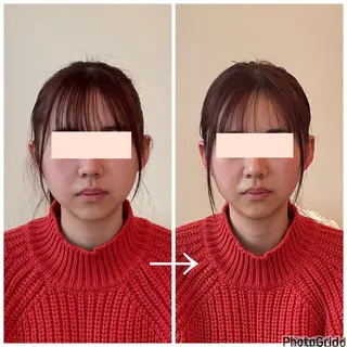 小顔矯正サロン　ReFace Fusae（リフェイスフサエ）所属・小顔矯正サロン リフェイスフサエのエステ・リラクイメージ