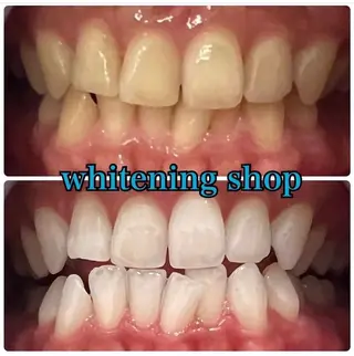 ホワイトニング ショップ吉祥寺店のエステ・リラクイメージ