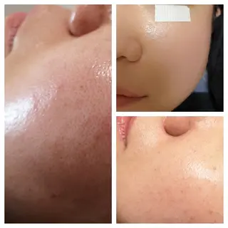 🅖🅤🅩🅔🅛 salonのエステ・リラクイメージ