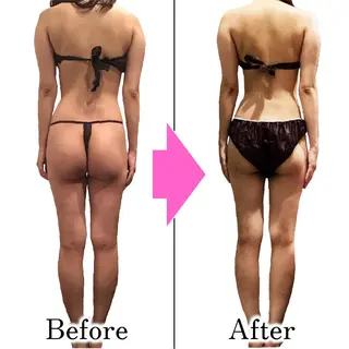 ダイエットラボ梅田店 🌟のエステ・リラクイメージ