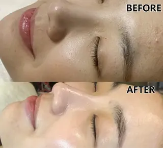 マツエク・マツパ aliaハイフ&水光ジェットサロン所属・aliaハーブ水光店 エステティシャン募集のエステ・リラクイメージ