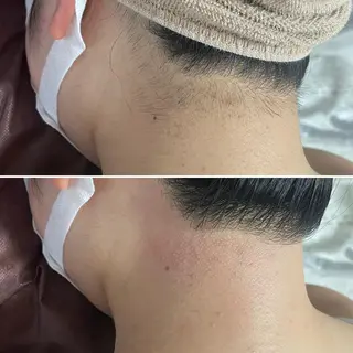 アイブロウ キッズ メンズ Epina 千葉店 【エピナ】のエステ・リラクイメージ