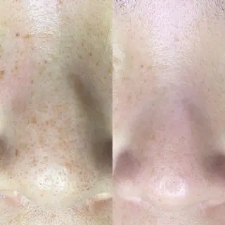 毛穴専門店MeMe.八千代店所属・\毛穴・頭皮/ のお悩みに特化💪のその他イメージ