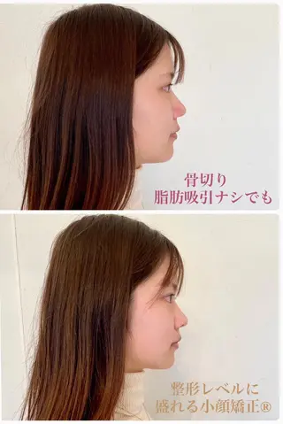 痛くない垢抜け小顔& 姿勢⭐︎AQUA-Bのエステ・リラクイメージ