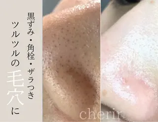 cherir所属・cherir大井町/ 毛穴ニキビ改善専門のエステ・リラクイメージ