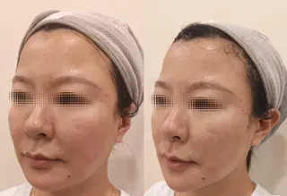 マツエク・マツパ aliaハイフ&水光ジェットサロン所属・aliaハーブ水光店 エステティシャン募集のエステ・リラクイメージ