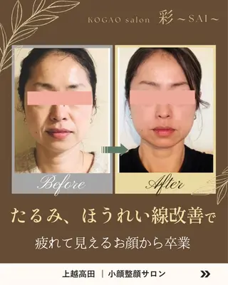 KOGAOsalon 彩～SAI～のエステ・リラクイメージ