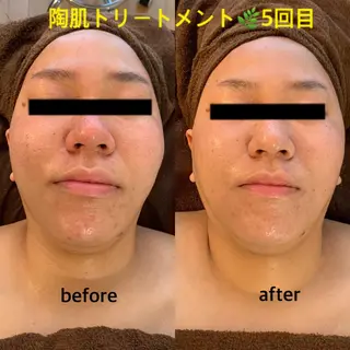 プライベートサロンsoleil所属・プライベートサロン soleilのエステ・リラクイメージ