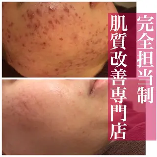 ミディアム カラー パーマ ヘアアレンジ メンズ キッズ ネイル マツエク・マツパ アイブロウ ニキビ・肌質改善専門 ♡人生が変わるサロンのエステ・リラクイメージ