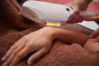 美楽鍼 びらくしんのその他イメージ