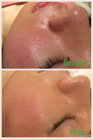 ロング カラー パーマ ヘアアレンジ メンズ キッズ ネイル マツエク・マツパ アニメ,Vオタク× 即効痩せエステサロンのエステ・リラクイメージ