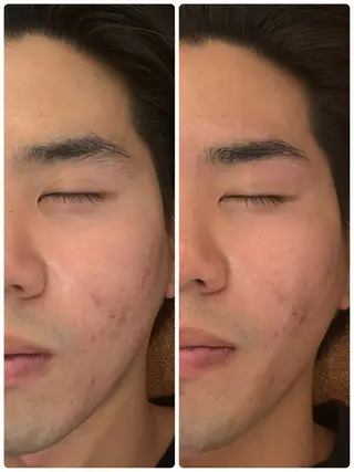 メンズ アイブロウ メンズガーデン今池店所属・メンズガーデン 今池の眉毛・アイブロウイメージ
