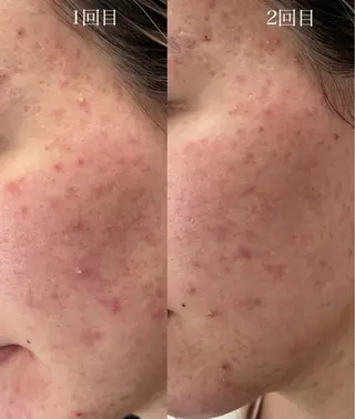 南部 杏奈のエステ・リラクイメージ