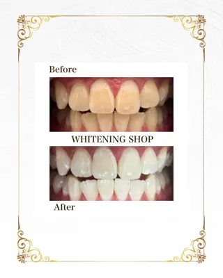 ホワイトニングショップ静岡葵区店所属・ホワイトニング ショップ葵区静岡駅店のその他イメージ