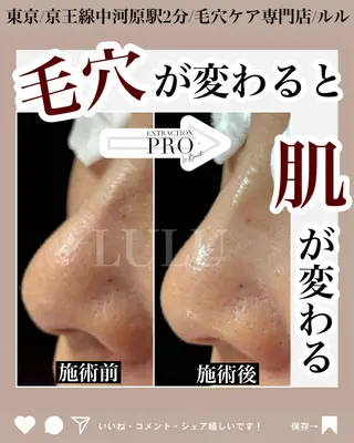 LULU所属・LULU ルルのエステ・リラクイメージ