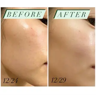 ハーブピーリング・毛穴ケア専門サロンSalon de LENA所属・ハーブピーリング 専門店/名古屋駅前店のその他イメージ