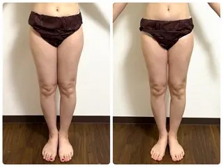 小顔ハーブピーリング 美容鍼/毛穴洗浄のエステ・リラクイメージ