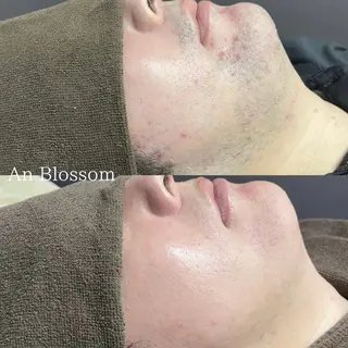 メンズ An Blossom所属・An Blossom 脱毛/茅ヶ崎/美咲のエステ・リラクイメージ