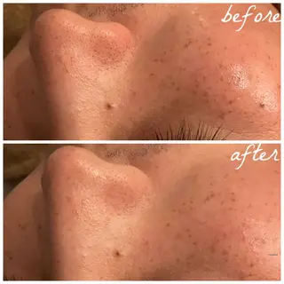 メンズ メナード岐阜市茜部 杉浦のエステ・リラクイメージ