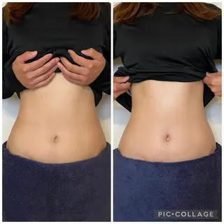 腸セラピーサロン ナチュモアのエステ・リラクイメージ