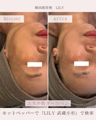 LILY所属・KAORU .のエステ・リラクイメージ