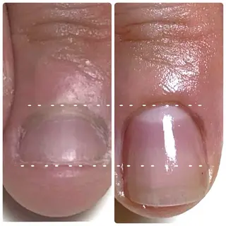 Nail ビ爪のネイルデザイン