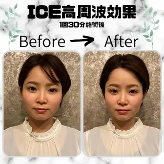 メンズ 男女同額完全個室脱毛 LEPIA内田のエステ・リラクイメージ