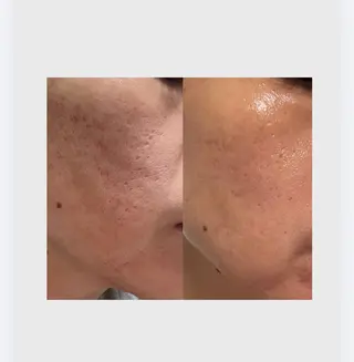 肌管理フェイシャル｜Utouto所属・肌管理フェイシャル Utoutoのエステ・リラクイメージ