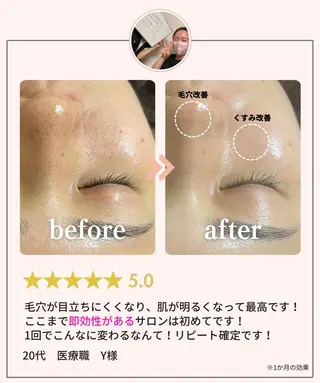 肌質改善・小顔サロン 20代店長RINNAのエステ・リラクイメージ