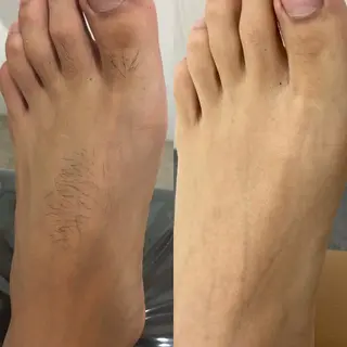 メンズ Beauty K's【ビューティーケイズ】所属・メンズ脱毛サロン ／金山昌弘のエステ・リラクイメージ