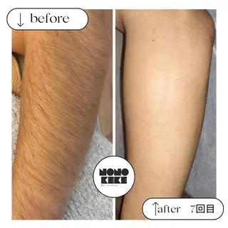 メンズ NONOKEKE ノノケケのエステ・リラクイメージ