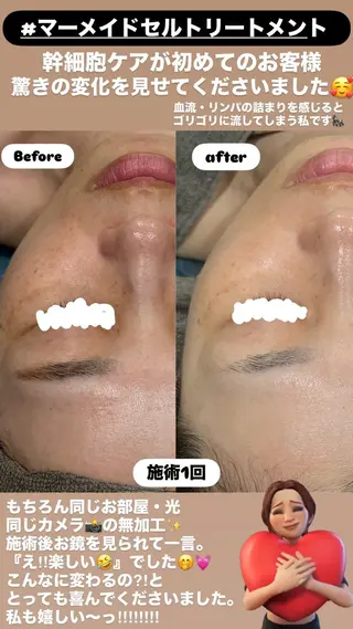 LiZA エステティックサロンのエステ・リラクイメージ