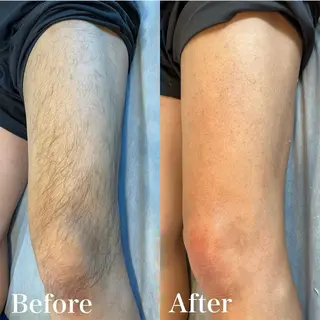 wax脱毛専門店 ハイラントのエステ・リラクイメージ