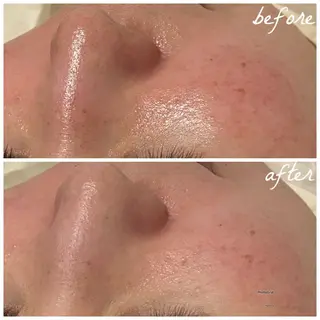 メンズ メナード岐阜茜部 杉浦のエステ・リラクイメージ