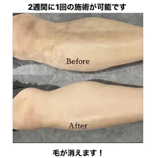 メンズ キッズ さろんどふじた甲子園所属・江嵜 真由美　　　　甲子園のマツエク・マツパデザイン