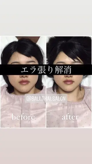 🌈歪み改善🌈 バリンタイ すぎうらのエステ・リラクイメージ