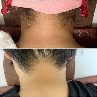 透明感の肌Lino malieのエステ・リラクイメージ