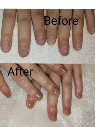 ネイル フィルイン、長さ出し 深爪矯正のネイルデザイン