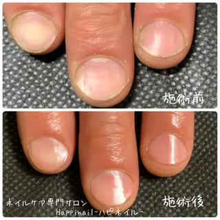 ネイル ケアが得意なサロン Happinailのエステ・リラクイメージ